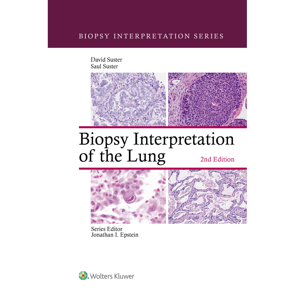 Suster. Biopsy Interpretation of the Lung (Biopsy Interpretation Series)  2 Edition eBook