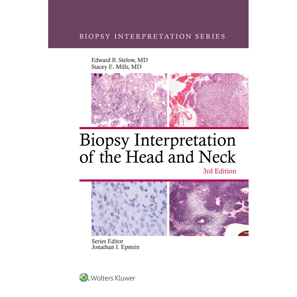 Stelow. Biopsy Interpretation of the Head and Neck (Biopsy Interpretation Series)  3 Edition eBook