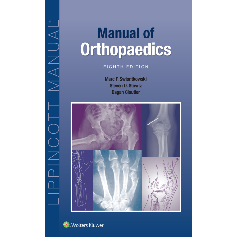 Swiontkowski. Manual of Orthopaedics (Lippincott Manual Series)  8 Edition eBook