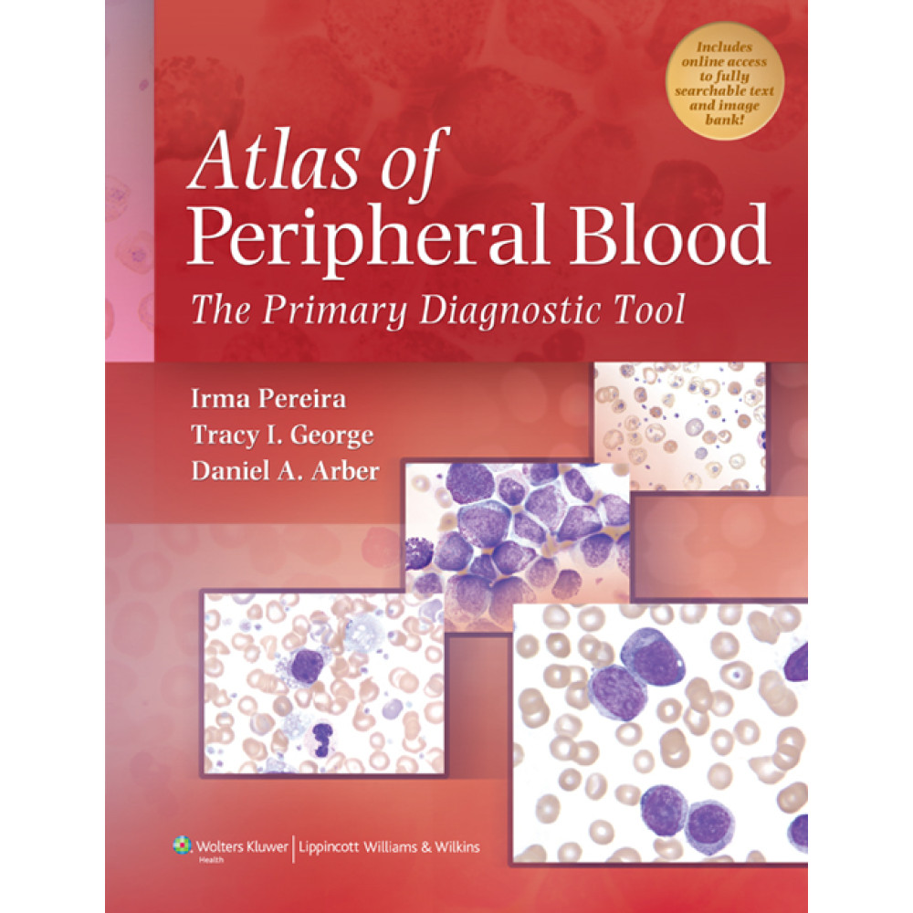 Pereira. Atlas of Peripheral Blood   Edition eBook