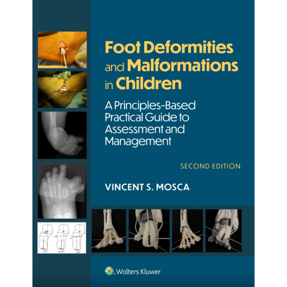 Mosca. Foot Deformities and Malformations in Children A Principles-Based, Practical Guide to Assessment and Management: eBook with Multimedia 2 Edition eBook
