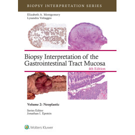 VOLTAGGIO. Biopsy Interpretation of the Gastrointestinal Tract Mucosa Volume 2 (Biopsy Interpretation Series) Neoplastic: eBook with Multimedia 4 Edition eBook