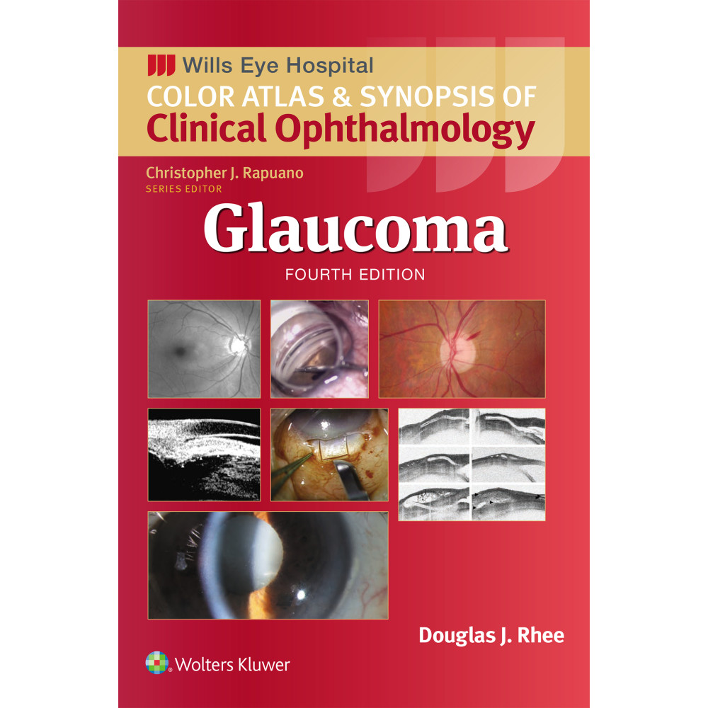 Rhee. Glaucoma (Wills Eye Institute Atlas Series)  4 Edition eBook