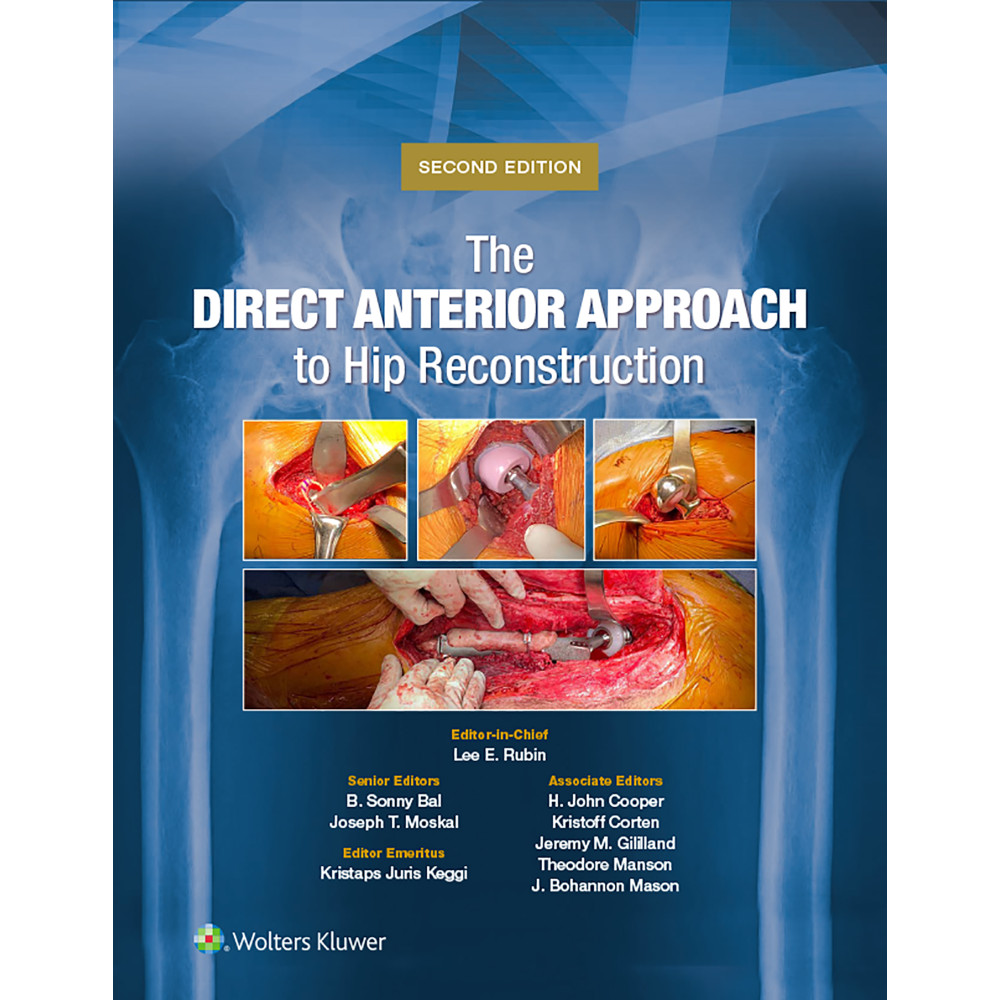 Rubin. The Direct Anterior Approach to Hip Reconstruction  2 Edition eBook