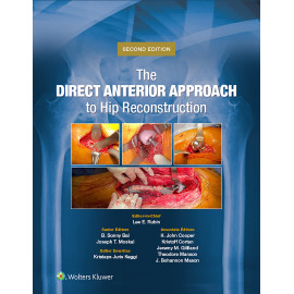 Rubin. The Direct Anterior Approach to Hip Reconstruction  2 Edition eBook